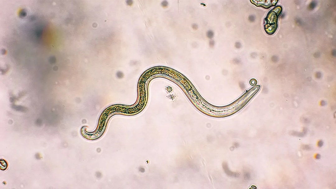ENFERMEDADES PARASITARIAS DE DECLARACIÓN OBLIGATORIA EN ESPAÑA
